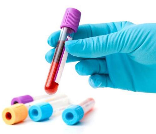 HIV-tesztek: értelmezés, típusok